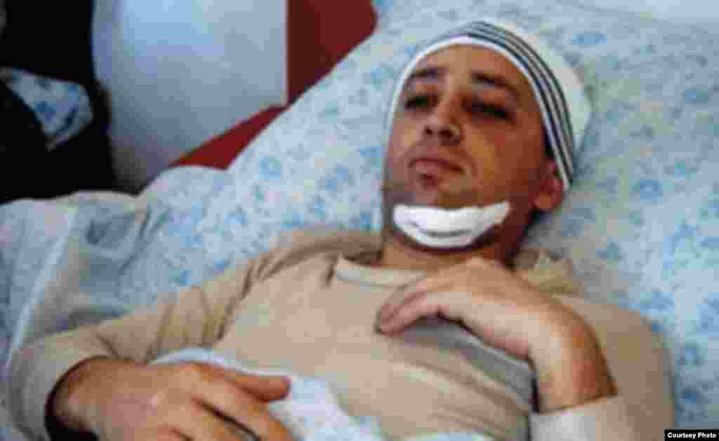 Fikrət Hüseynli, "Azadlıq" qəzetinin əməkdaşı. 2006-cı il martın 6-da Bakıda döyülüb. 